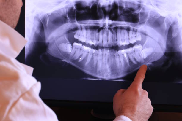 Best Emergency Dentist for Lost Fillings or Crowns in Nd Point, WI